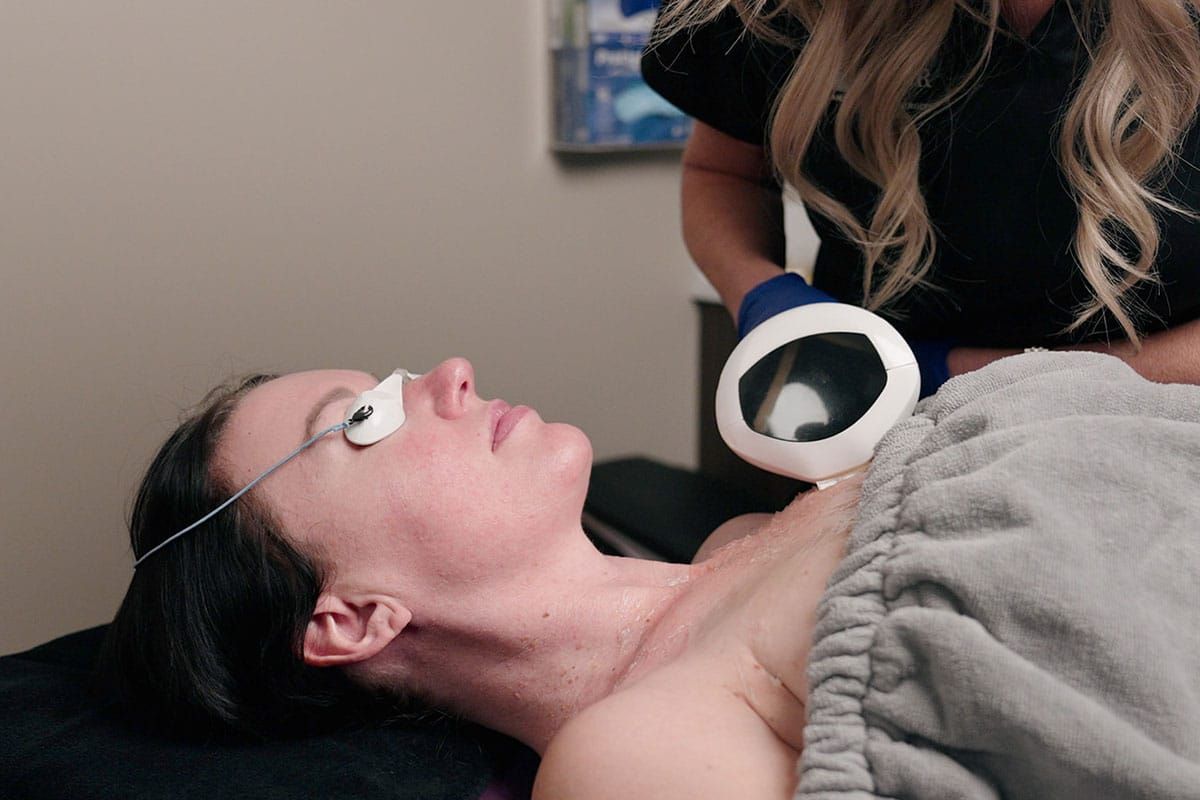 indianapolis age spot treatment patient mid procedure