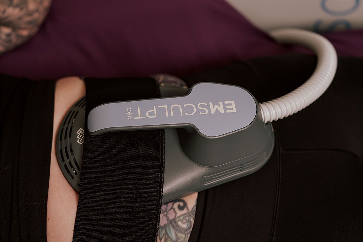 indianapolis emsculpt neo patient receiving treatment