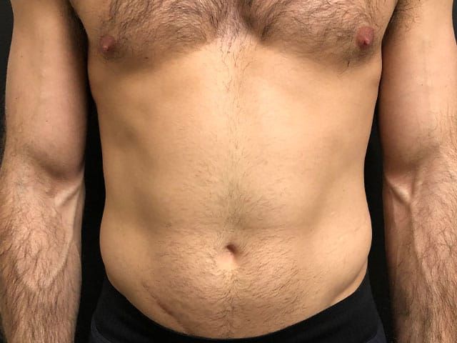 Cooltone Before & After