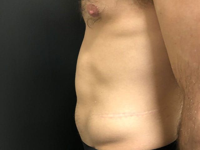 Cooltone Before & After