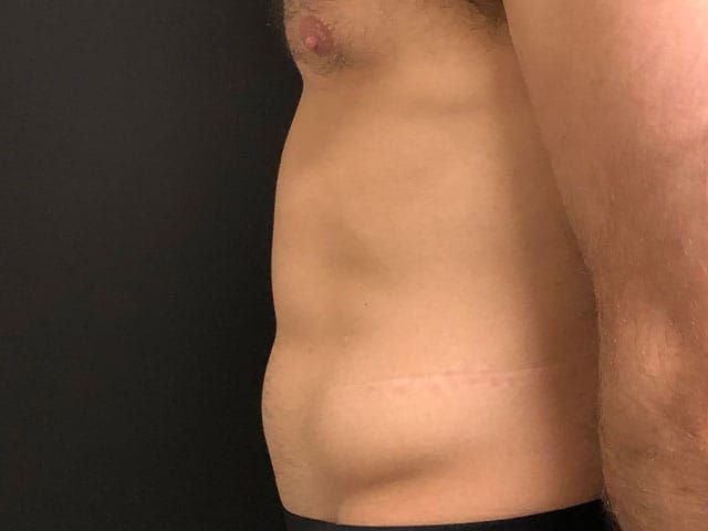 Cooltone Before & After