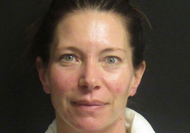 Chin Jawline Before & After