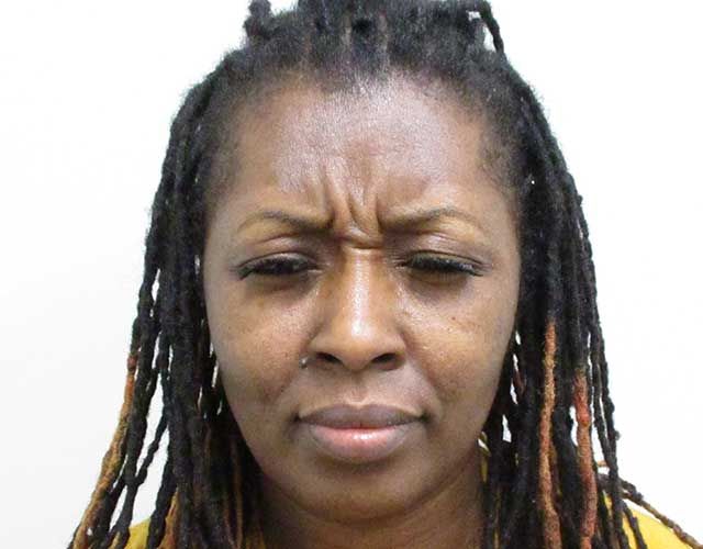 Botox Before & After