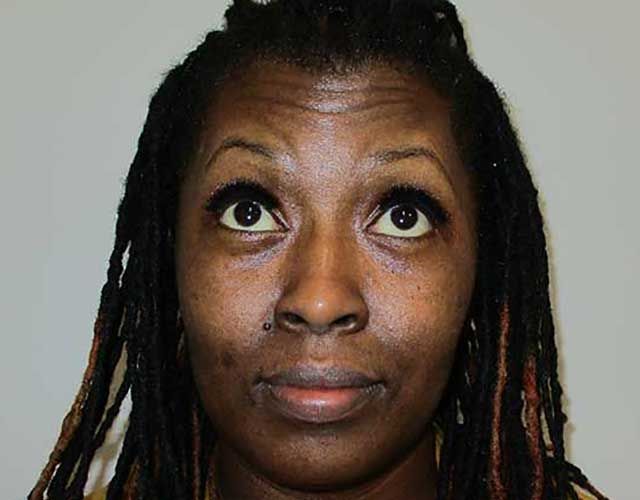 Botox Before & After