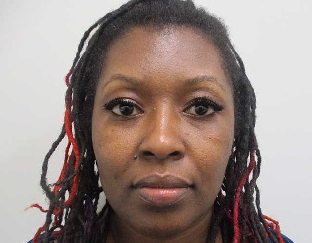 Botox Before & After