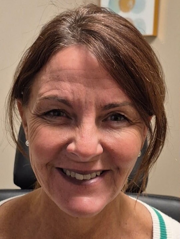 Botox Before & After