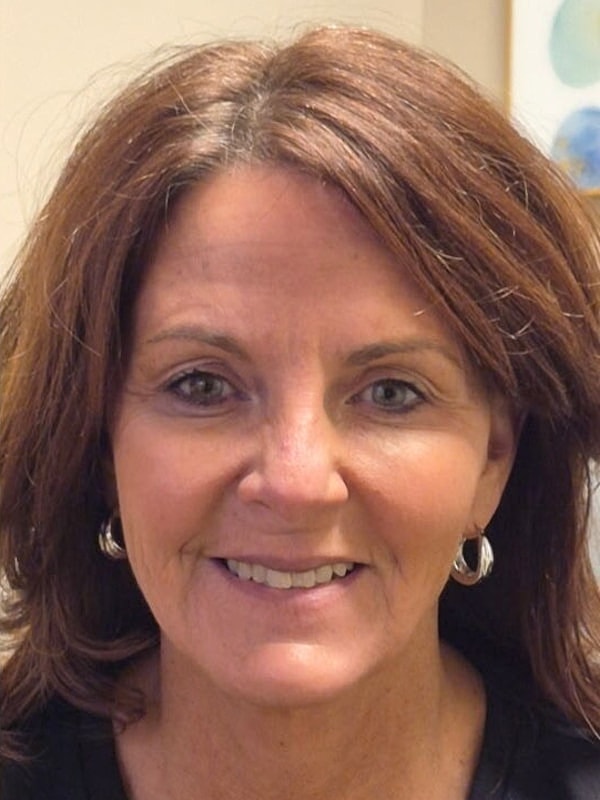 Botox Before & After