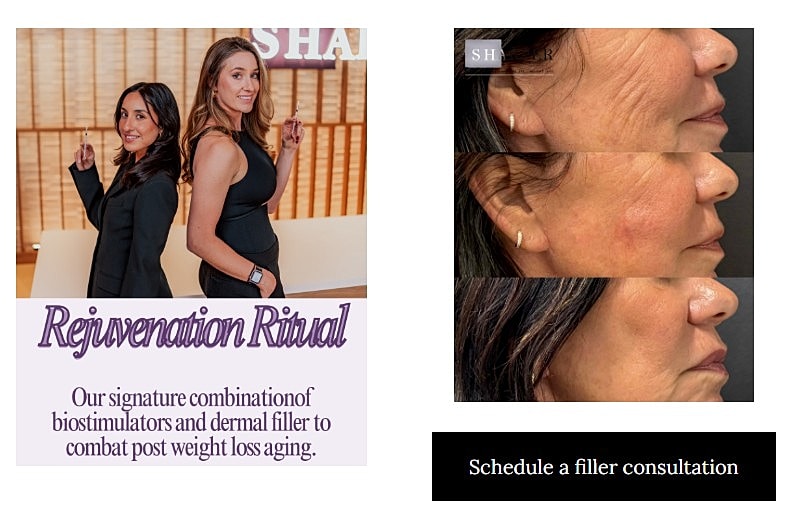 Rejuvenation treatments and filler consultation promotion.